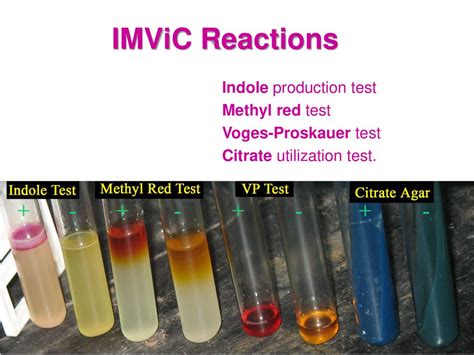 methyl red and voges-proskauer test|1.27: MR.